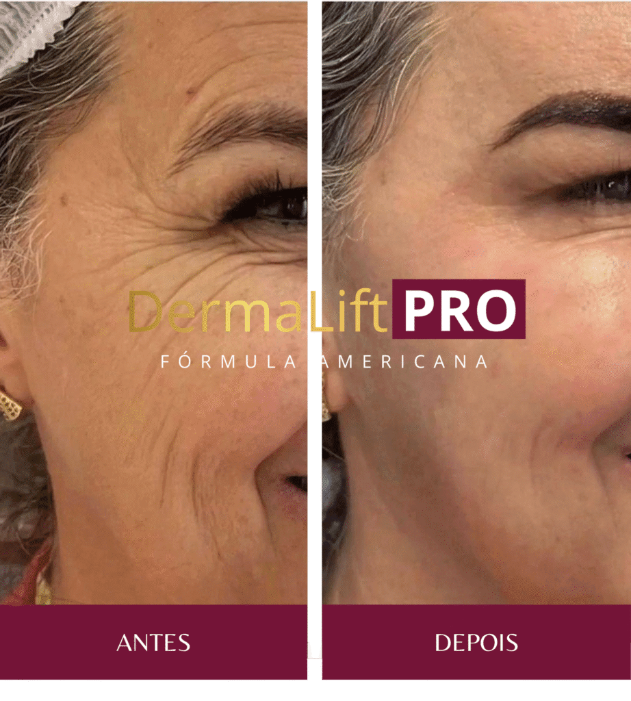 derma-lift-pro-site-oficial