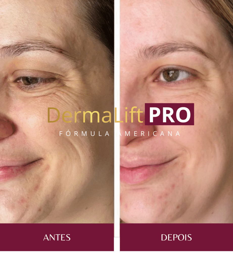 derma-lift-pro-site-oficial